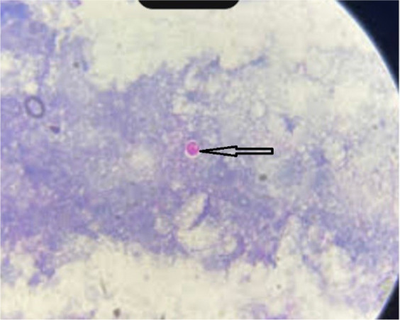 Prevalence and risk factors of <i>Cryptosporidium</i> spp. and <i>Giardia</i> infestation in cattle and in broiler chickens in Algeria.