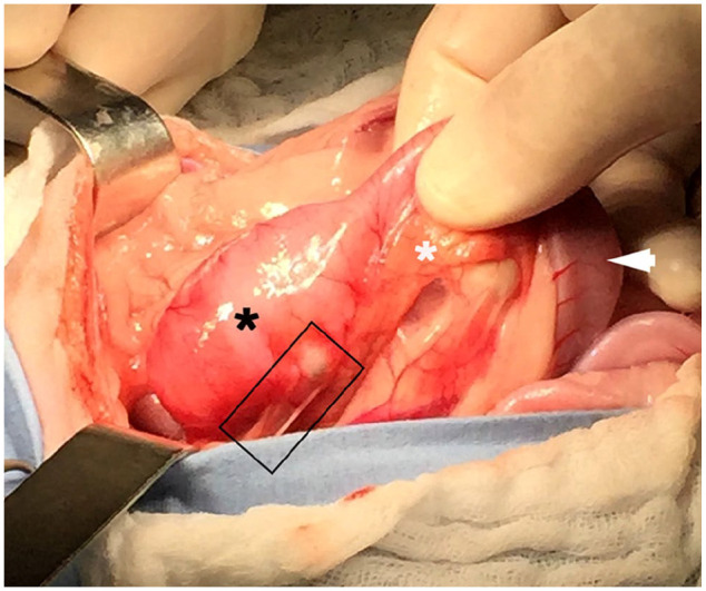 Feline eosinophilic sclerosing fibroplasia of the duodenum treated with gastrojejunostomy in a domestic shorthair cat.