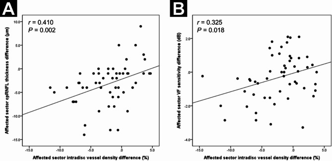 Changes in optic nerve head microvasculature following disc hemorrhage absorption in glaucomatous eyes.