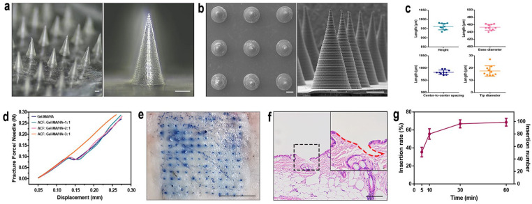 Dissolving microneedle patch loaded with adipokines-enriched adipose extract relieves atopic dermatitis in mouse via modulating immune disorders, microbiota imbalance, and skin barrier defects.