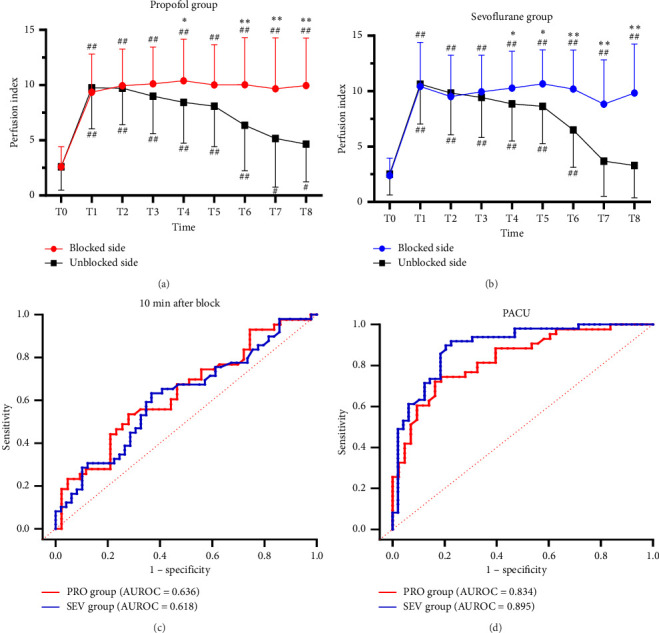 Perfusion Index Predicts the Effectiveness of Supraclavicular Brachial Plexus Block in Children Under General Anesthesia: A Randomized Controlled Trial.