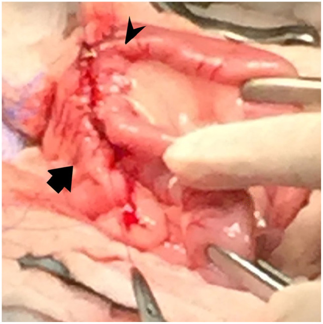 Feline eosinophilic sclerosing fibroplasia of the duodenum treated with gastrojejunostomy in a domestic shorthair cat.
