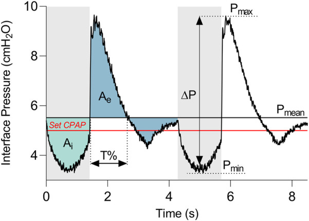 Impact of circuit configuration on the mechanical performance of CPAP therapy devices: an experimental study.