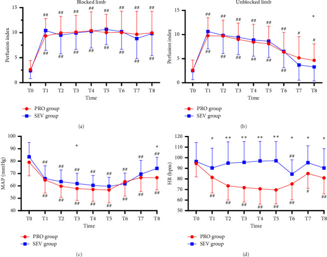 Perfusion Index Predicts the Effectiveness of Supraclavicular Brachial Plexus Block in Children Under General Anesthesia: A Randomized Controlled Trial.
