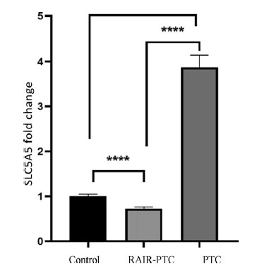 The effect of SLC5A5 gene expression in tumor tissues on refractoriness to radioactive iodine treatment of differentiated thyroid carcinomas.