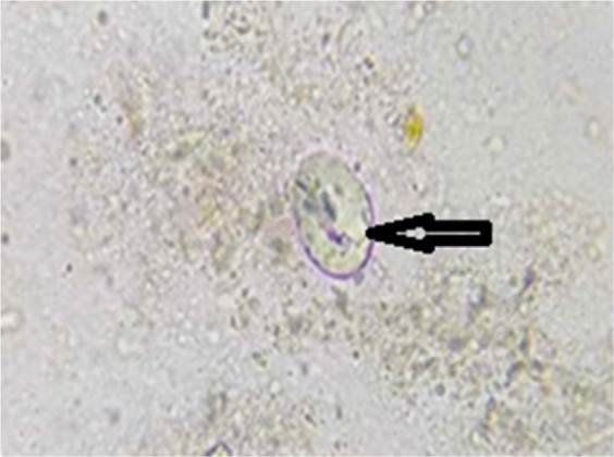 Prevalence and risk factors of <i>Cryptosporidium</i> spp. and <i>Giardia</i> infestation in cattle and in broiler chickens in Algeria.