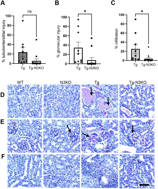 Notch3 deletion regulates HIV-1 gene expression and systemic inflammation to ameliorate chronic kidney disease.