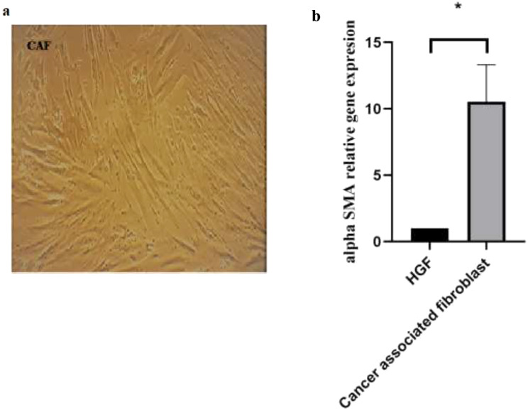 Effect of conditioned medium from miRNA-34a transfected gastric cancer-associated fibroblast on peripheral blood mononuclear cells.