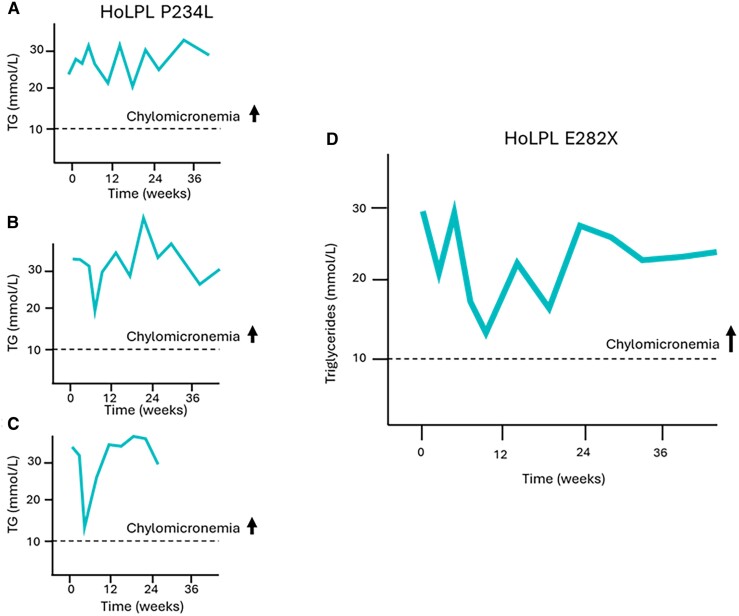 Treatment With Evinacumab Links a New Pathogenic Variant in the LPL Gene to Persistent Chylomicronemia.