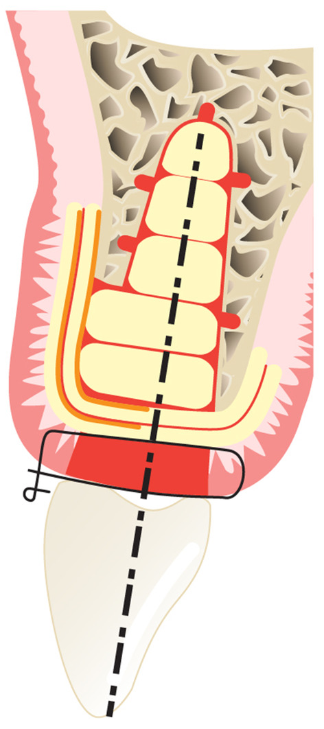 Instructions for the use of L-PRF in different clinical indications.