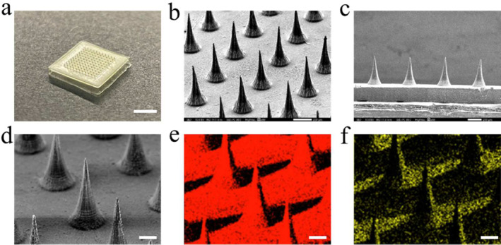 MXene-Integrated Responsive Hydrogel Microneedles for Oral Ulcers Healing.