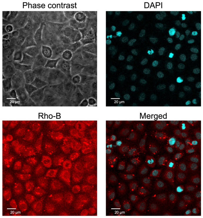 Novel Epigenetics Control (EpC) Nanocarrier for Cancer Therapy Through Dual-Targeting Approach to DNA Methyltransferase and Ten-Eleven Translocation Enzymes.