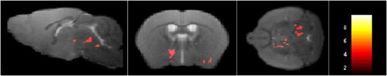 Nebulized seabuckthorn seed oil inhalation attenuates Alzheimer's disease progression in APP/PS1 mice.