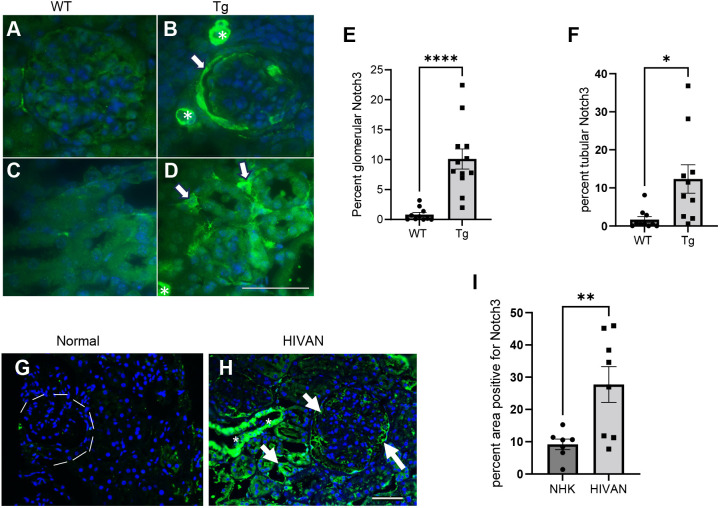 Notch3 deletion regulates HIV-1 gene expression and systemic inflammation to ameliorate chronic kidney disease.