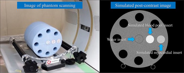 Basic verification of myocardial extracellular volume quantification by prototype photon-counting detector computed tomography: A phantom study.