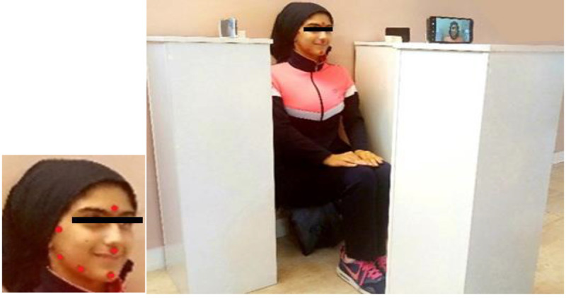 Assessment of Mandibular Kinematic Variables using a Motion Analysis System and a Regular Mobile Phone.