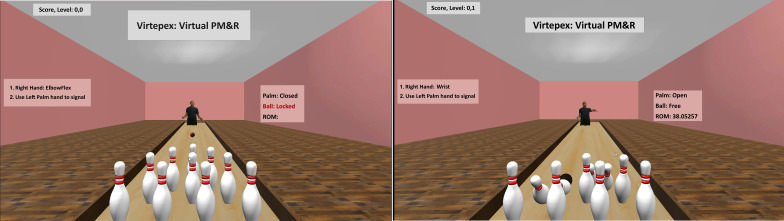 Comparing In-Person, Standard Telehealth, and Remote Musculoskeletal Examination With a Novel Augmented Reality Exercise Game System: Pilot Cross-Sectional Comparison Study.