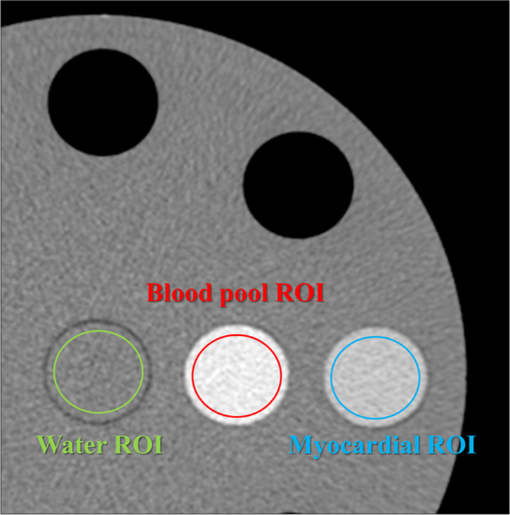 Basic verification of myocardial extracellular volume quantification by prototype photon-counting detector computed tomography: A phantom study.