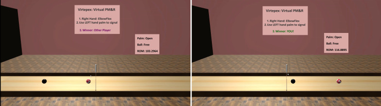 Comparing In-Person, Standard Telehealth, and Remote Musculoskeletal Examination With a Novel Augmented Reality Exercise Game System: Pilot Cross-Sectional Comparison Study.