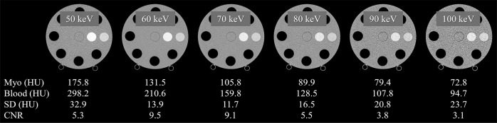 Basic verification of myocardial extracellular volume quantification by prototype photon-counting detector computed tomography: A phantom study.