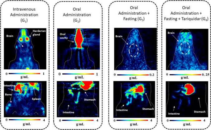 Oral Administration of [<sup>18</sup>F]MC225 for Quantification of P-glycoprotein Function: A Feasibility Study.