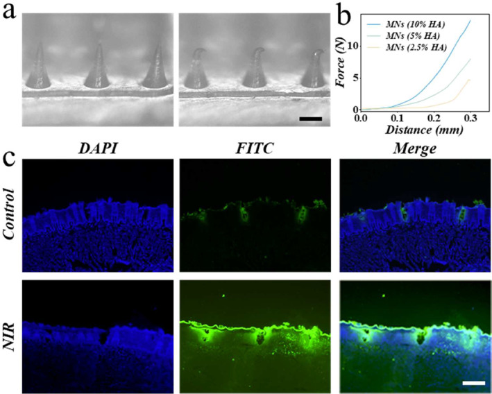 MXene-Integrated Responsive Hydrogel Microneedles for Oral Ulcers Healing.