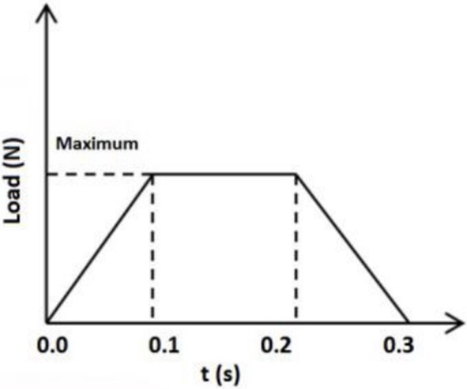 Case analysis and finite element analysis of adult head skull fractures in people run over by motor vehicles.