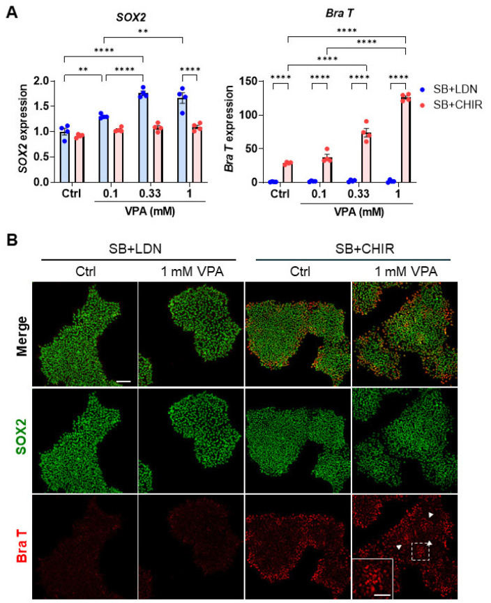 The Differential Developmental Neurotoxicity of Valproic Acid on Anterior and Posterior Neural Induction of Human Pluripotent Stem Cells.