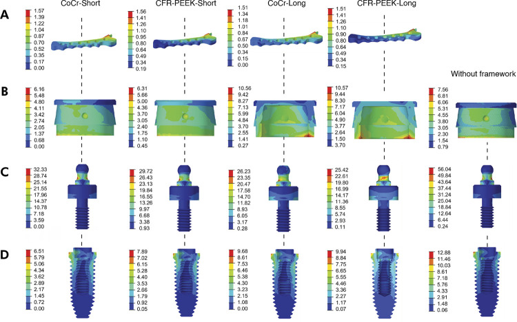 Carbon fiber-reinforced PEEK as a framework material for single implant-retained mandibular overdentures.
