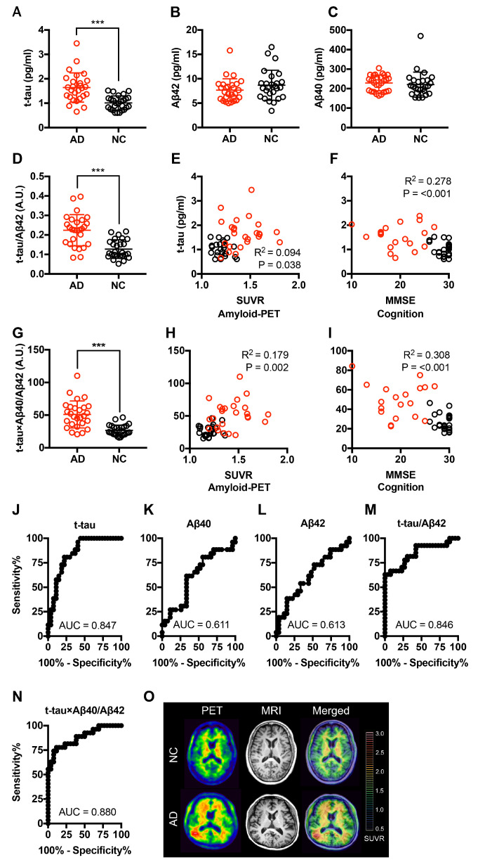 Combination of Aβ40, Aβ42, and Tau Plasma Levels to Distinguish Amyloid-PET Positive Alzheimer Patients from Normal Controls.