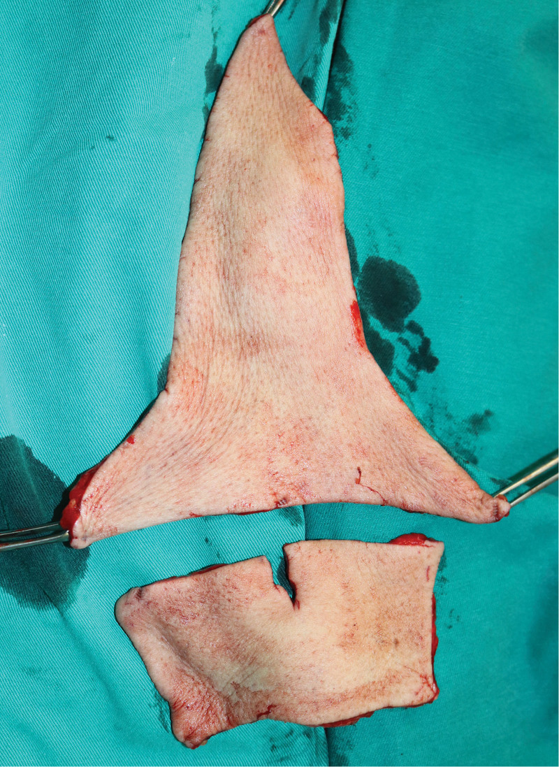 摘要图片