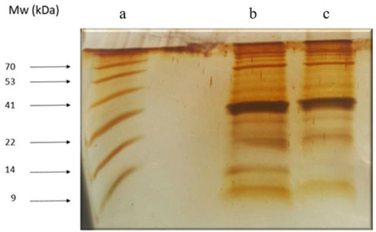 In vitro investigations of coelomic fluid of <i>Eisenia fetida</i>: protein analysis, antioxidant activities and antibacterial effects on diabetic wounds' bacteria.