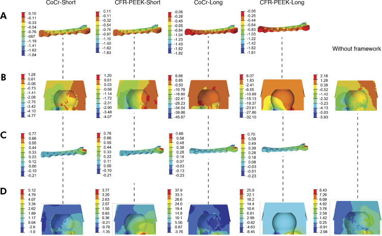 Carbon fiber-reinforced PEEK as a framework material for single implant-retained mandibular overdentures.