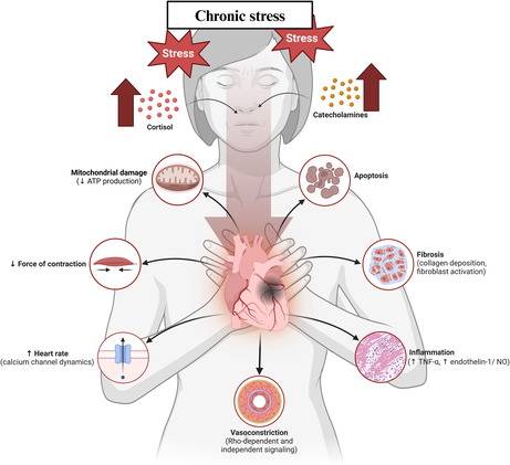 The Role of Chronic Stress in the Pathogenesis of Ischemic Heart Disease in Women.