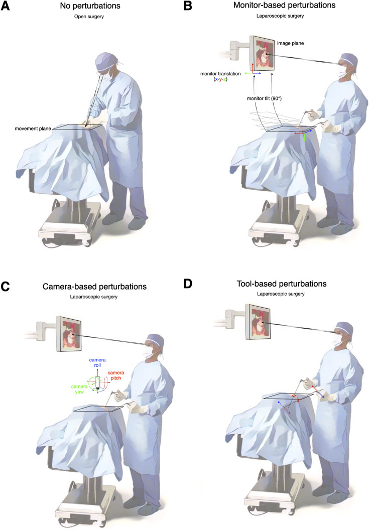 Sensorimotor Challenges in Minimally Invasive Surgery: A Theoretically-Oriented Review.