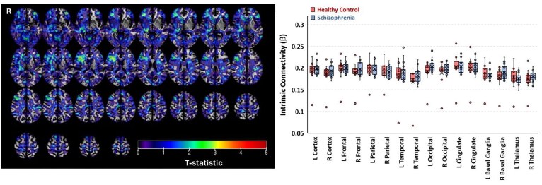Abnormal arteriolar blood volume measured by 3D inflow-based vascular-space-occupancy (iVASO) MRI and resting-state BOLD fluctuations at 7 T in individuals with recent-onset schizophrenia.