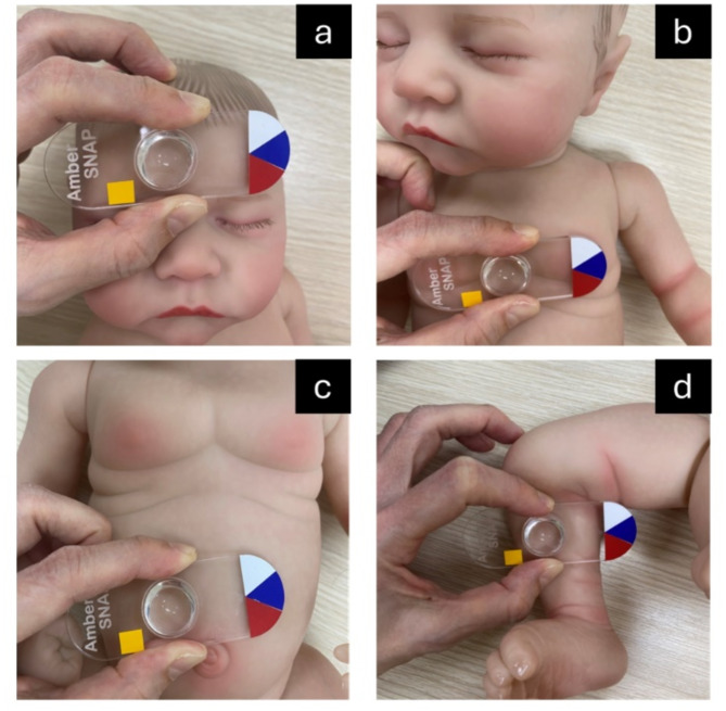 Feasibility study of texture-based machine learning approach for early detection of neonatal jaundice.