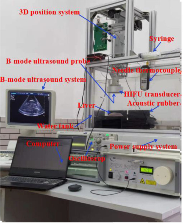 Study on the Effect of Lesion Volume and Focal Temperature Caused by HIFU Combined with Different Concentrations and Volumes of Ethanol on Porcine Liver.