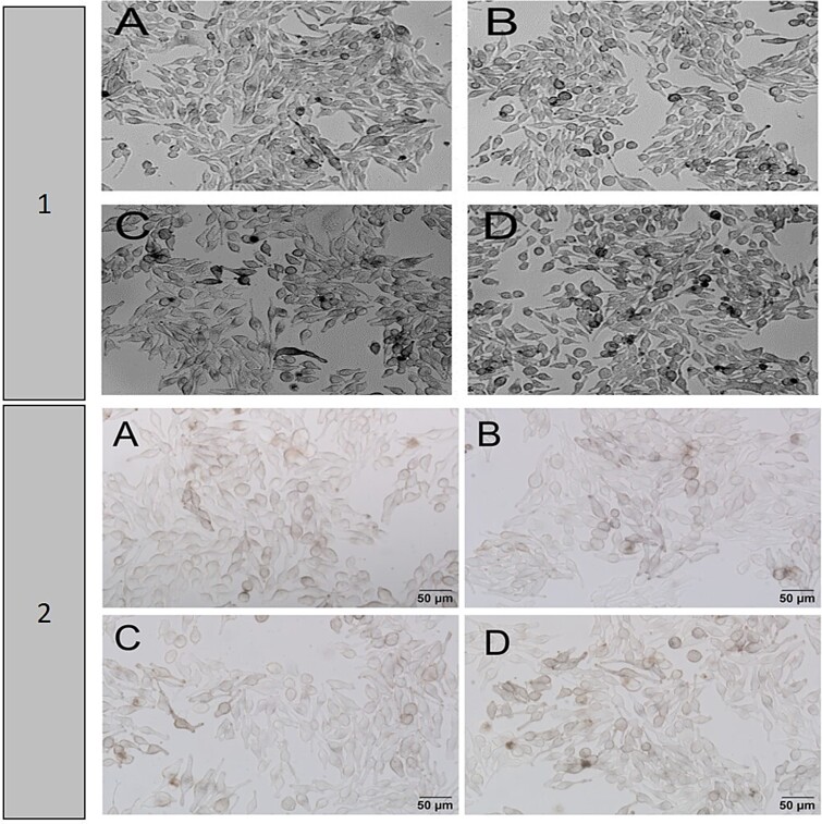 Comparative in vitro and in silico evaluation of the toxic effects of metformin and/or ascorbic acid, new treatment options in the treatment of Melasma.