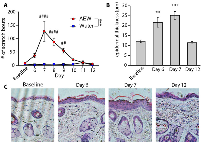 Acetone-Ether-Water Mouse Model of Persistent Itch Fully Resolves Without Latent Pruritic or Cross-Modality Priming.