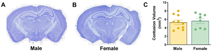 Sex-based differences in the long-term fate of hippocampal neurons born after a traumatic brain injury.
