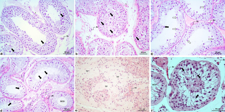 Testicular tissue bank: ten years of testicular tissue cryopreservation in Croatia.