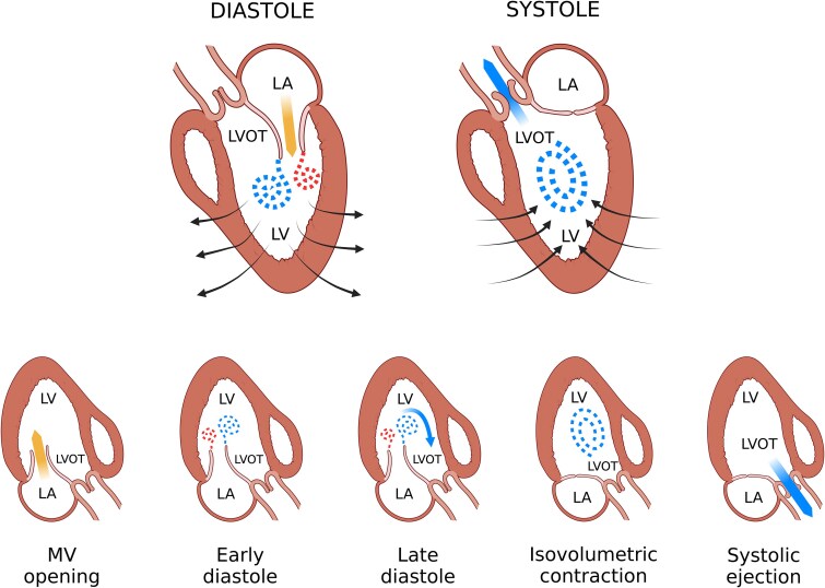 Intracardiac flow dynamics in mitral regurgitation: state of the art.