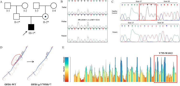 A Novel Pathogenic Splicing Mutation of <i>OFD1</i> is Responsible for a Boy with Joubert Syndrome Exhibiting Orofaciodigital Spectrum Anomalies, Polydactyly and Retinitis Pigmentosa.