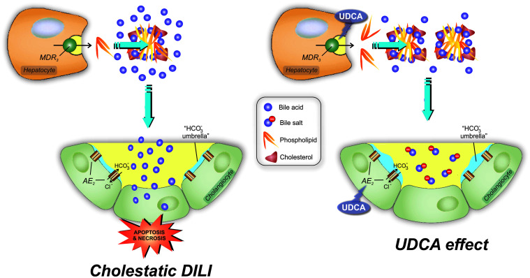 Ursodeoxycholic Acid for the Management of Drug-induced Liver Injury: Role of Hepatoprotective and Anti-cholestatic Mechanisms.