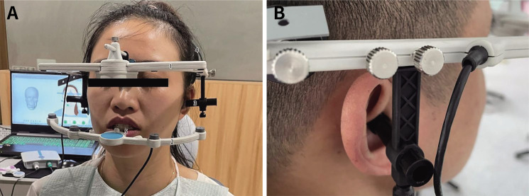 Comparison of the accuracy of an ultrasonic-based jaw tracking device with conventional electronic tracking device.