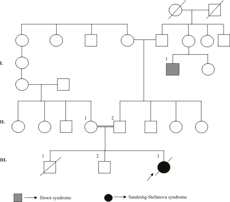 A Novel Truncating Variant in Sandestig-Stefanova Syndrome with Hydrocephalus.