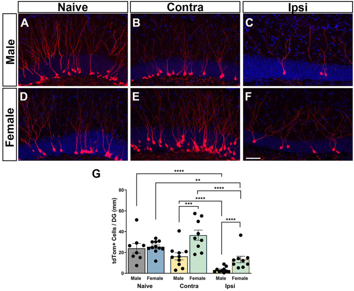Sex-based differences in the long-term fate of hippocampal neurons born after a traumatic brain injury.