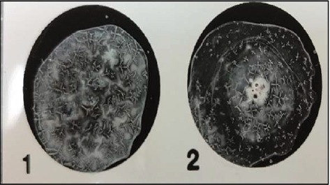 Identification of <i>mcr-2</i> and <i>mcr-3</i> Genes in Colistin-Resistant <i>E. coli</i> O157:H7 Isolated From Raw Meat Samples in Beirut, Lebanon.