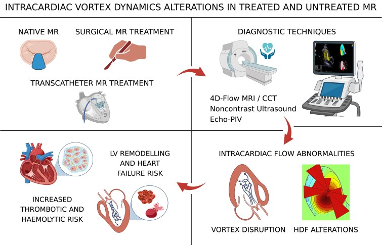 Intracardiac flow dynamics in mitral regurgitation: state of the art.